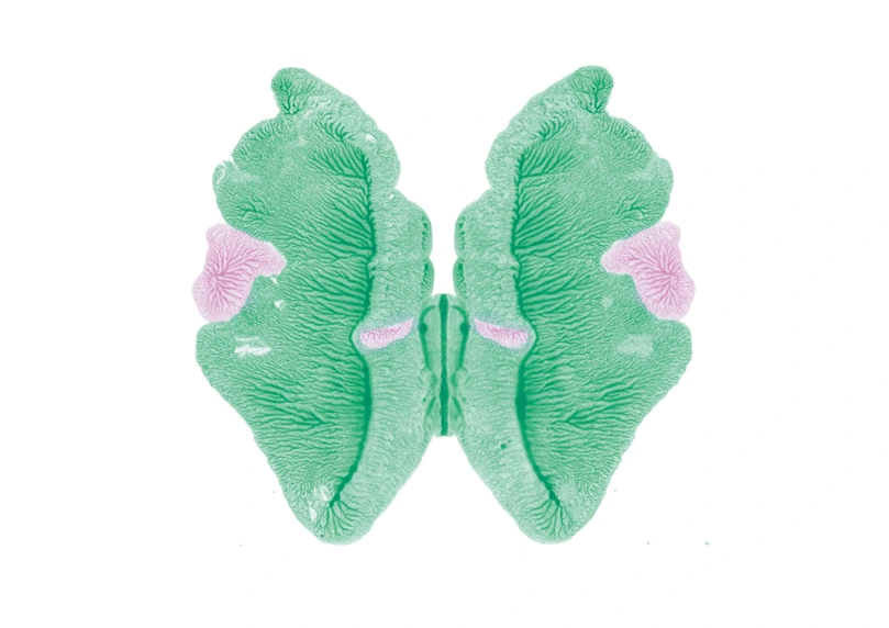 R.D.S-056, Rorschach Drawing Series